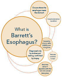 Barrett's Esophagus Image