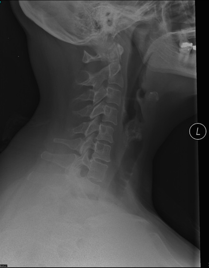 neck x-ray