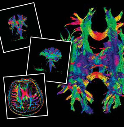 contrast MRI